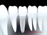 Smile Care Dental Clinic image 1